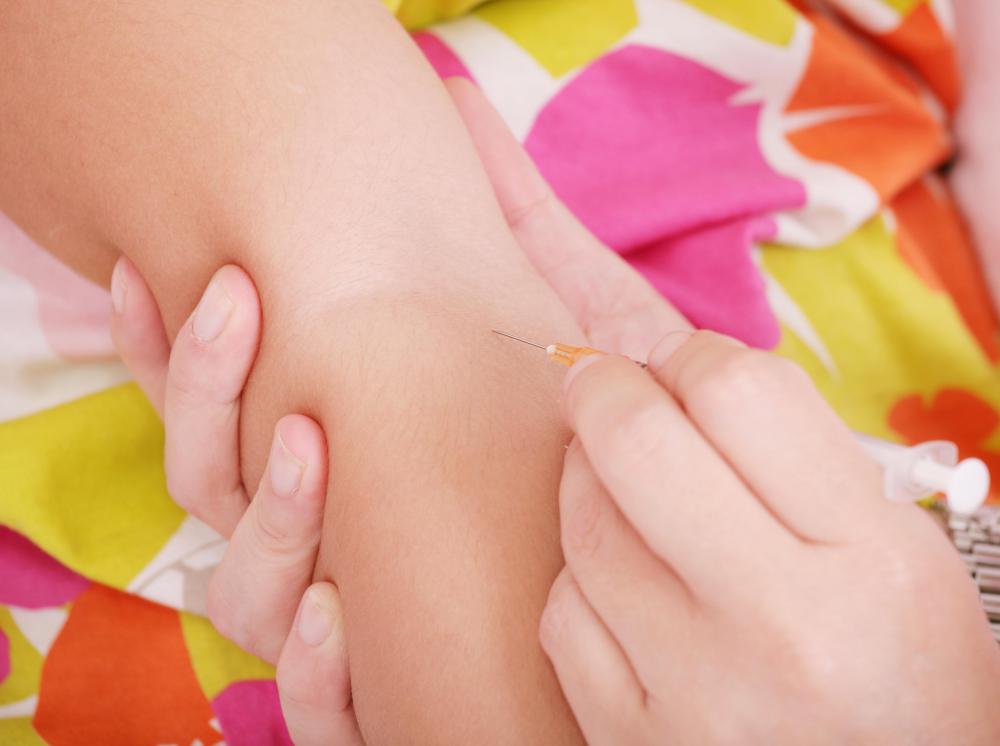 Tuberculosis, a lung infection, can be diagnosed by a skin test.