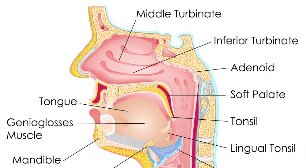Abnormally enlarged tonsil tissue is referred to as tonsil hypertrophy.