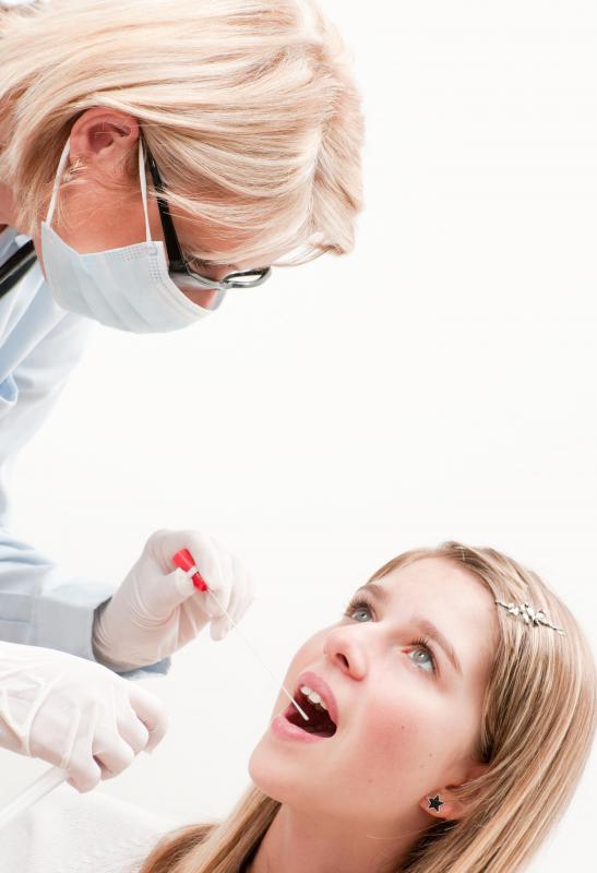 Strep throat requires antibiotics for treatment.