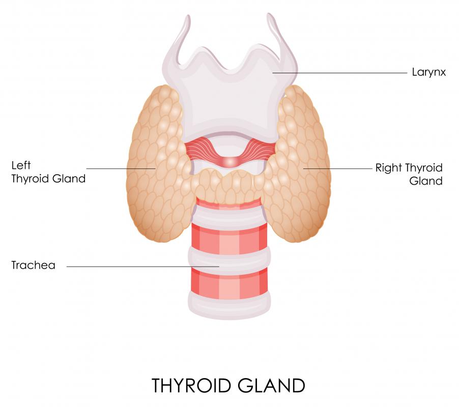 Iodide ions are used in the treatment of hyperactive thyroids.