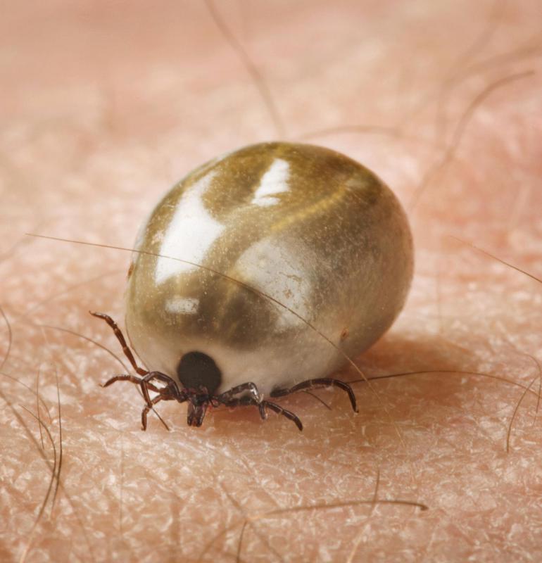 Take special care when removing a tick so that a health professional can later inspect it for disease, which can help a doctor determine whether you need to take antibiotics.