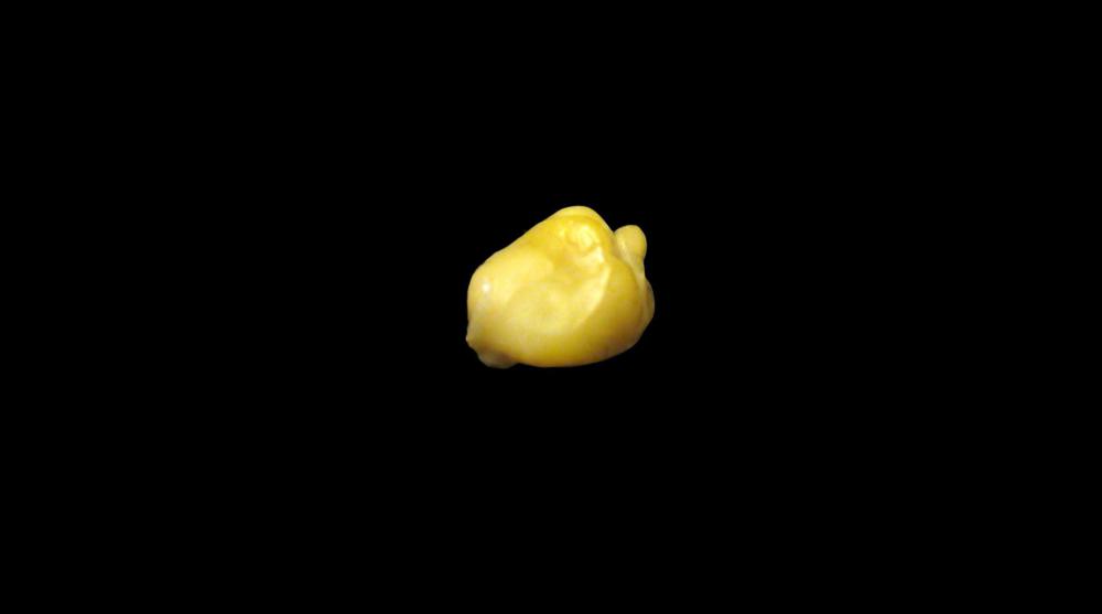 Tonsil cysts, or tonsil stones, are small, yellowish in color, and form in the back of the throat within the tonsils.