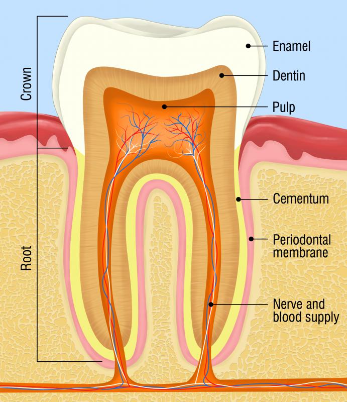 A broken tooth should not be self-treated.