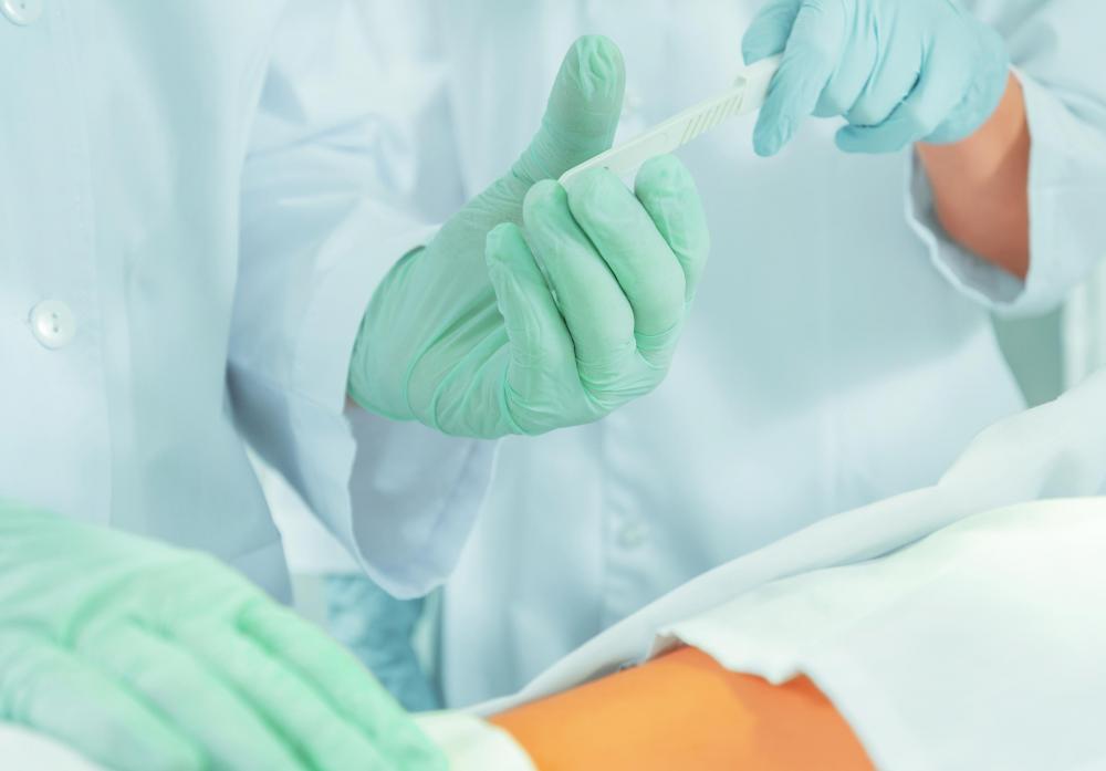 Damage to the genitofemoral nerve may occur as a complication of surgery.