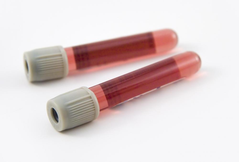 Near infrared spectroscopy is often used to test blood samples for oxygen concentration or other factors.