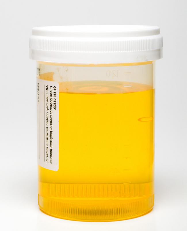A urine sample will need to be submitted to a laboratory prior to a cystourethroscopy.