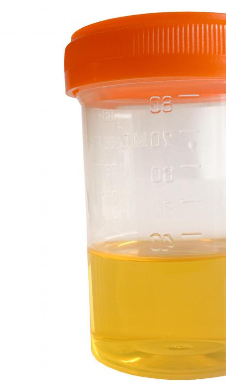 Chromatography is performed on urine samples used for drug tests.