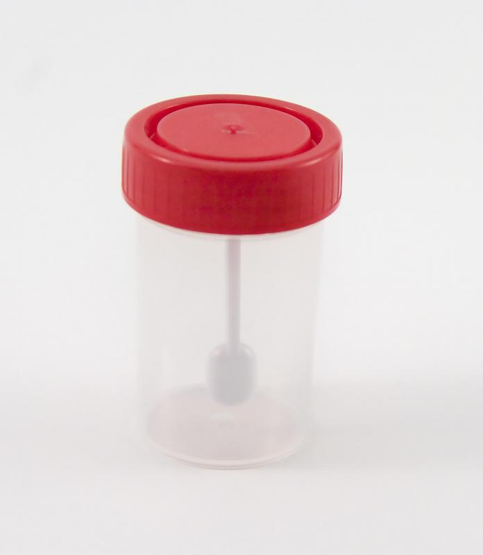 A stool sample may be required to diagnose the presence of clostridium botulism.