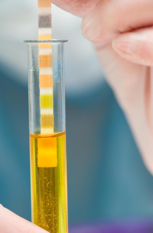 An ELISA test might use a test strip to test urine.