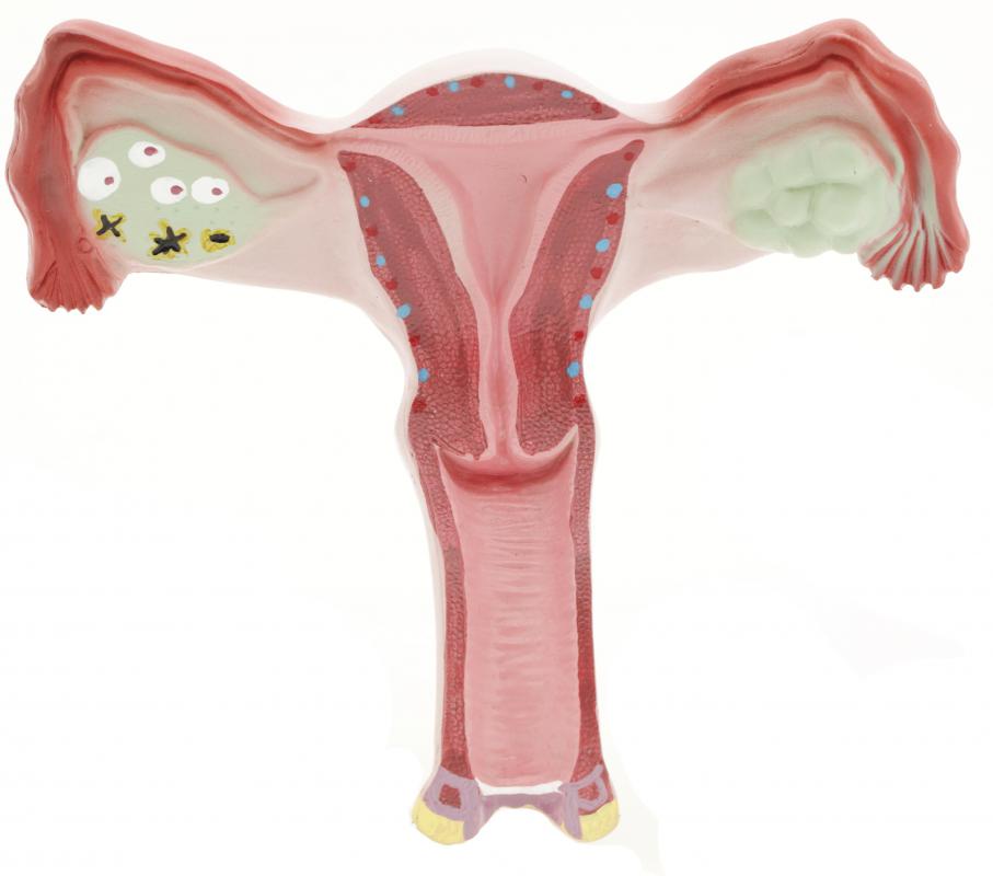 In severe cases of uterine prolapse, the uterus can begin to leave the body completely.