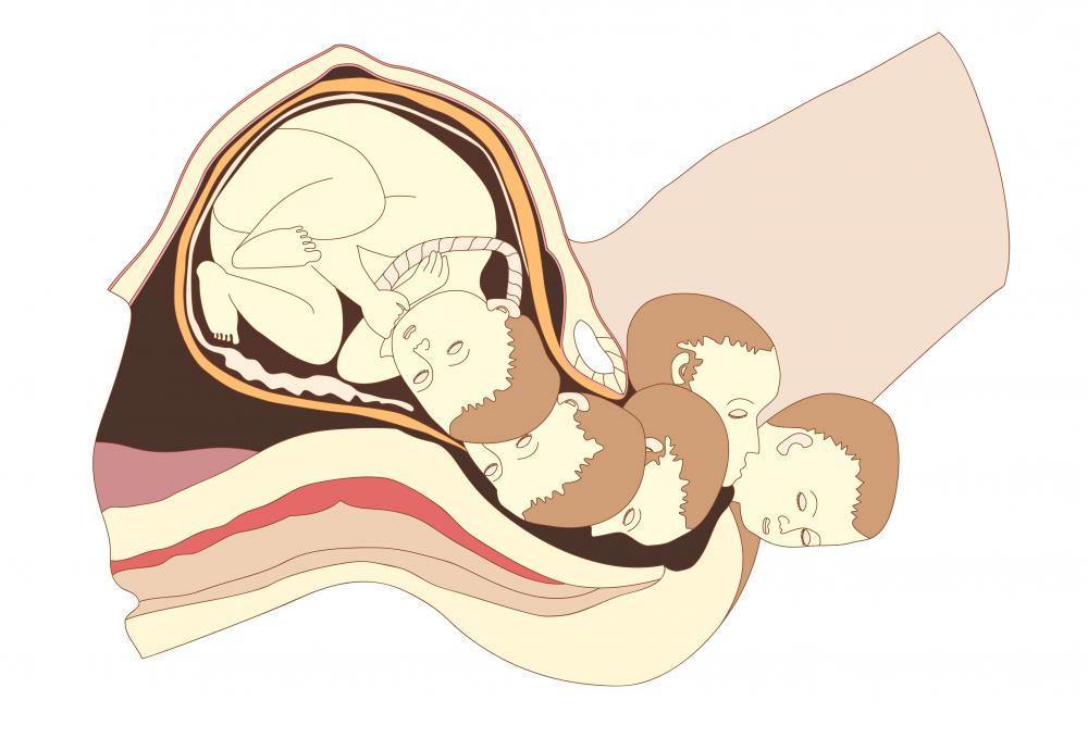 The vaginal wall is extremely elastic, allowing or childbirth.