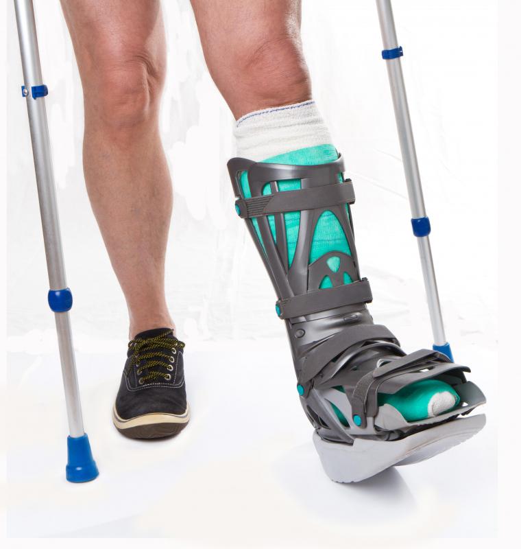 Weight-bearing cast.