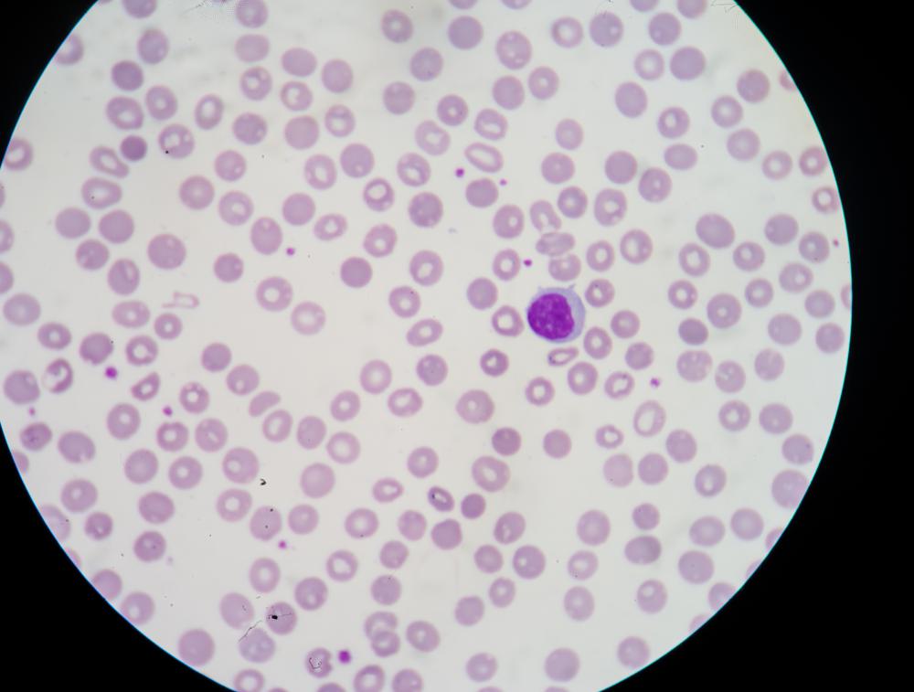 A phagocyte is a type of white blood cell.