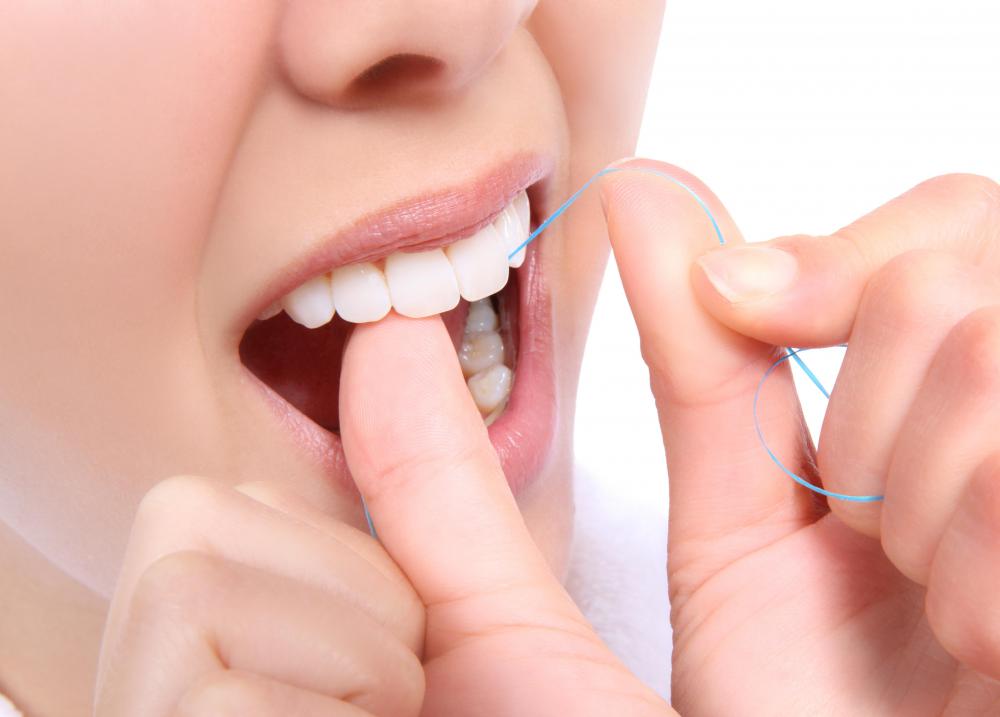 Flossing may help prevent gingivitis.