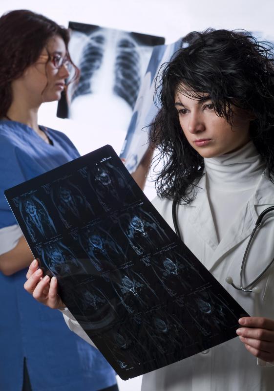 Advanced medical imaging technology has made it easier to detect retroperitoneal adenopathy without invasive procedures.