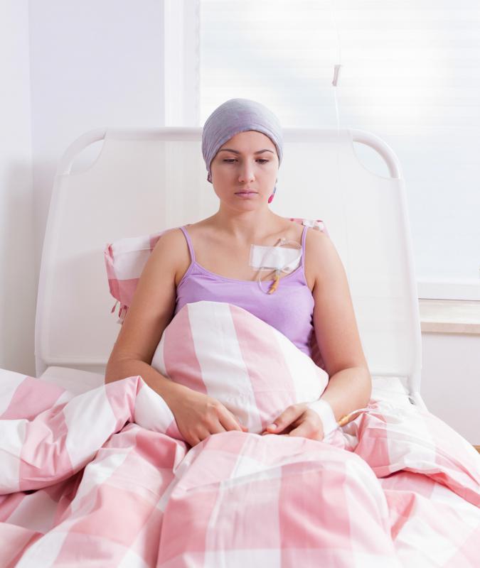 A chemotherapy catheter is often placed near where the jugular merges with the subclavian vein, then emerges just below the collarbone.