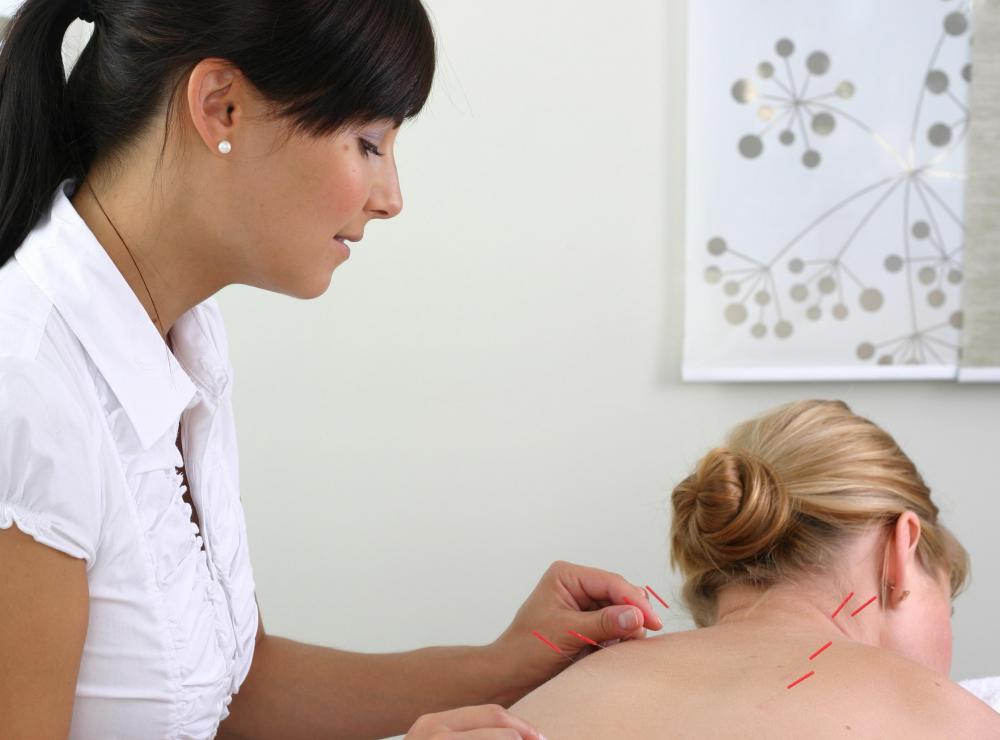Acupuncture has been used as a healing technique for over 2000 years.