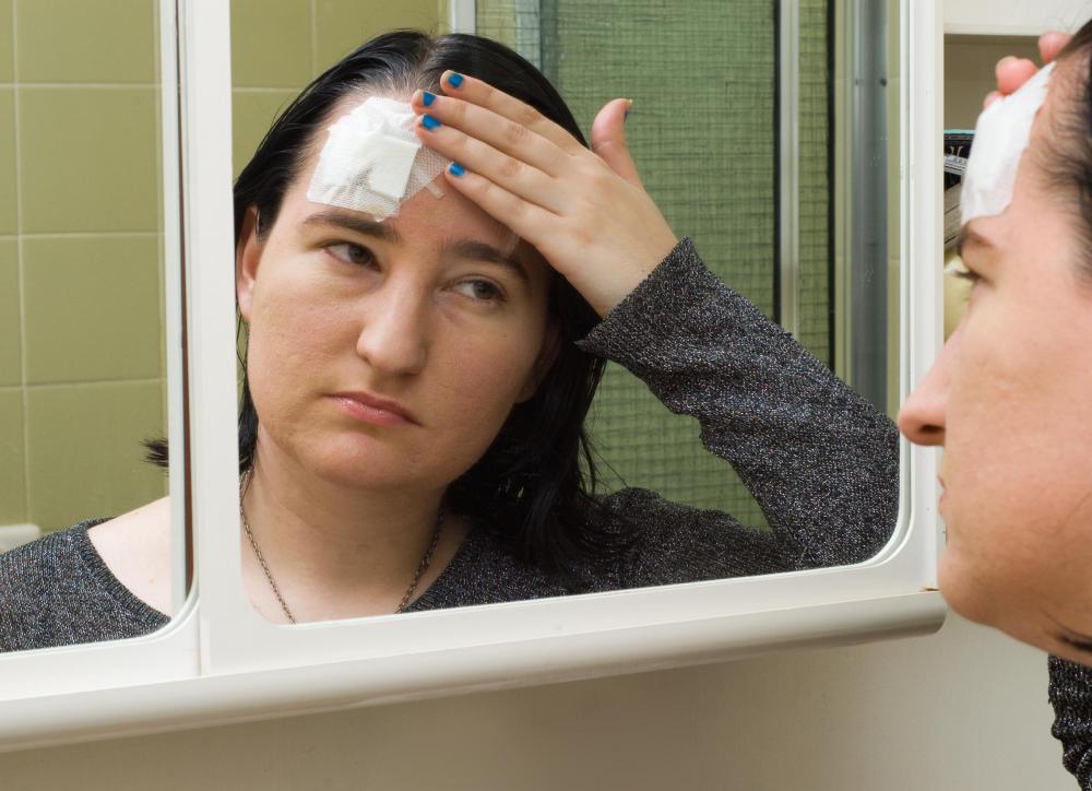 Individuals who suffer from a severe head injury are more prone to develop a cerebral edema.