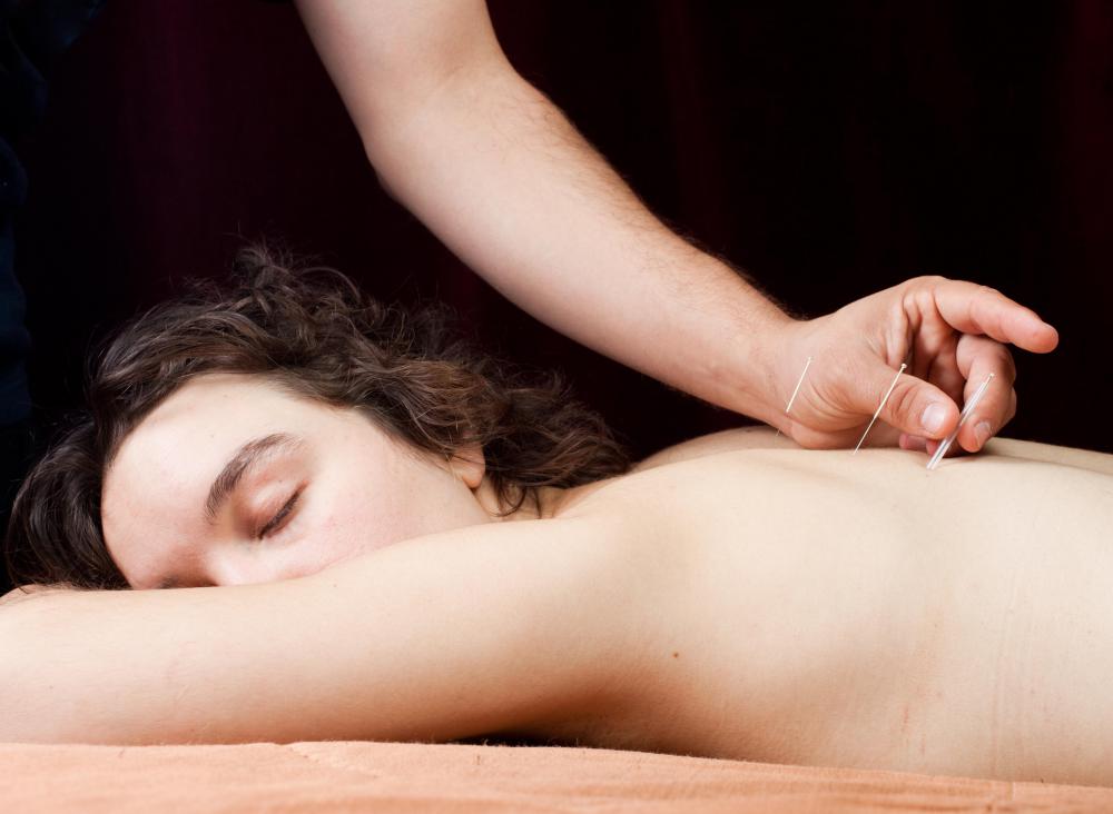 Some people with viral cadiomyopathy may benefit from alternative therapies like acupuncture to help improve their circulation.