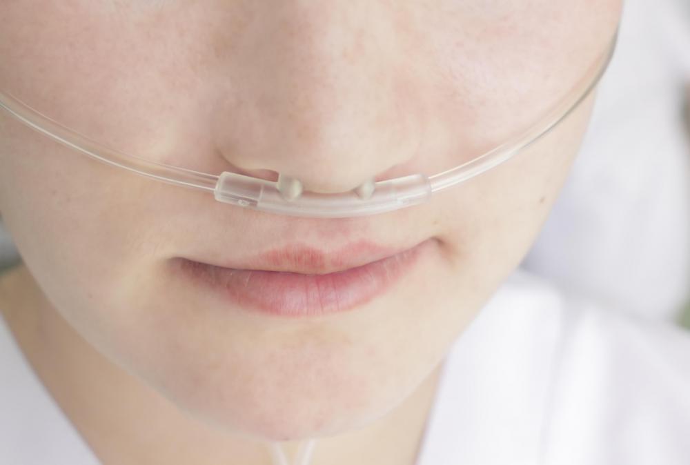 Treatment for perioral cyanosis may include oxygen therapy.