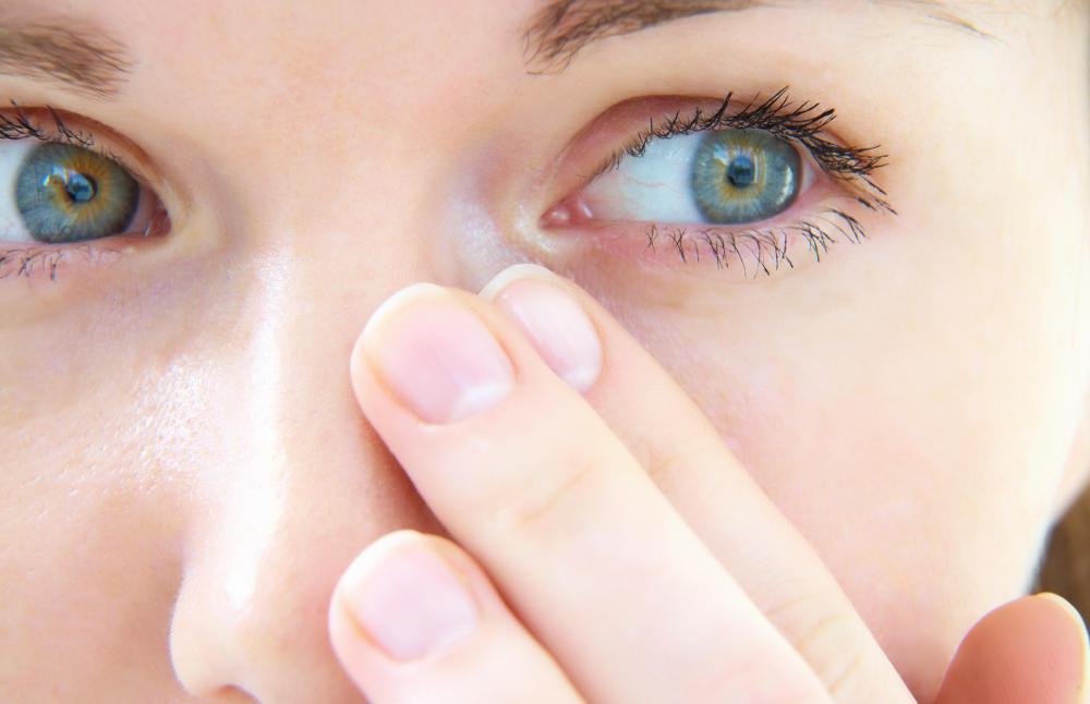 Optic nerve hypoplasia is a congenital condition.