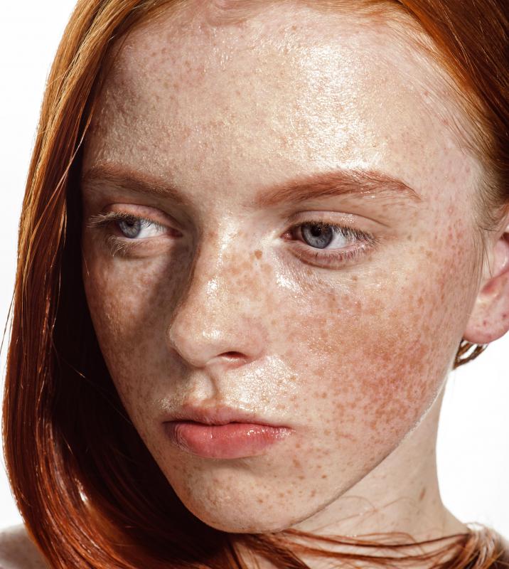 A woman with freckles on her face.