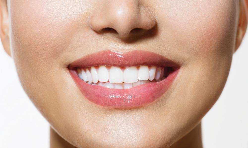 Sonic toothbrushes have been shown to whiten teeth better than traditional toothbrushes.
