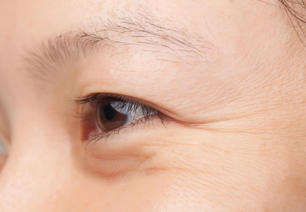 Fish collagen may be used to help reduce the appearance of wrinkles.