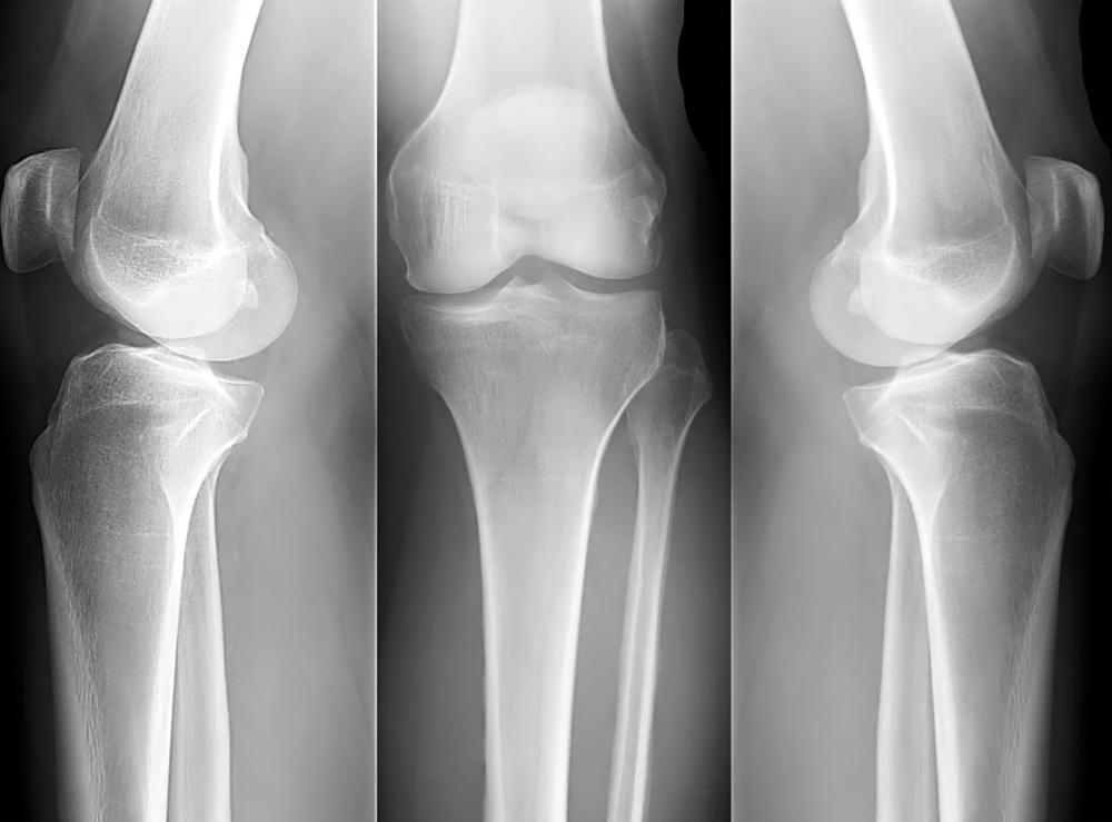Orthopedic specialists work with the muscles, joints and ligaments associated with the skeletal system.
