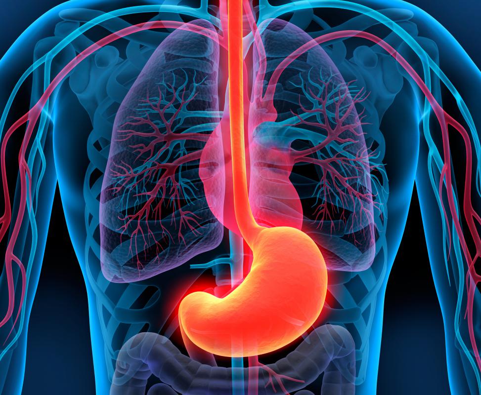 Peptic ulcers are most commonly seen in an individual with gastrinomas.