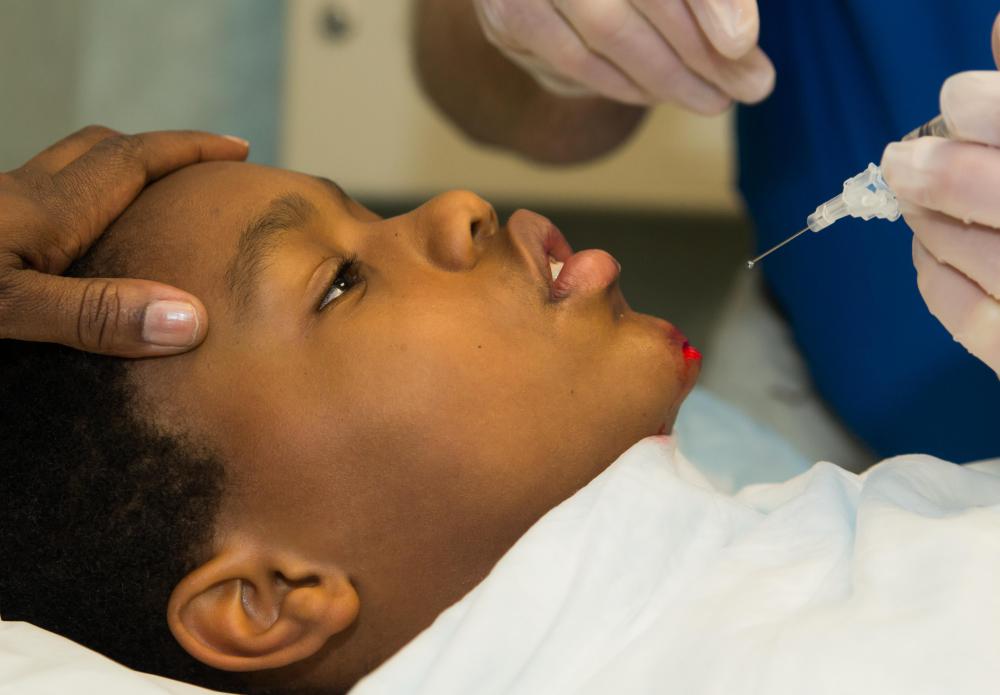 A numbing agent is typically administered before stitches are performed on a patient.