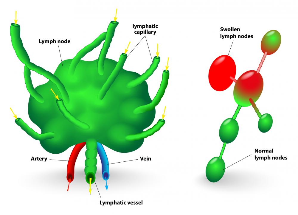 what does shotty inguinal lymph nodes means