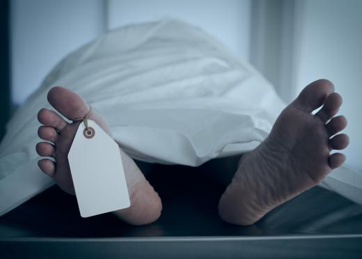 Rigor mortis occurs when the muscles in the body begin to stiffen after death.