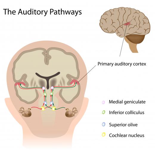 The auditory cortex makes sense of information that has been sent to it along auditory pathways from the ear.