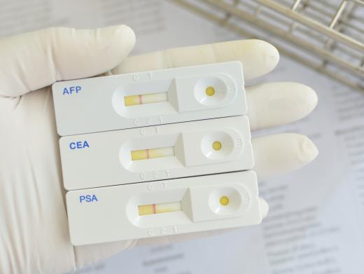 A PSA test can be used at home or a laboratory to detect the Prostrate Specific Antigens that are found in semen.