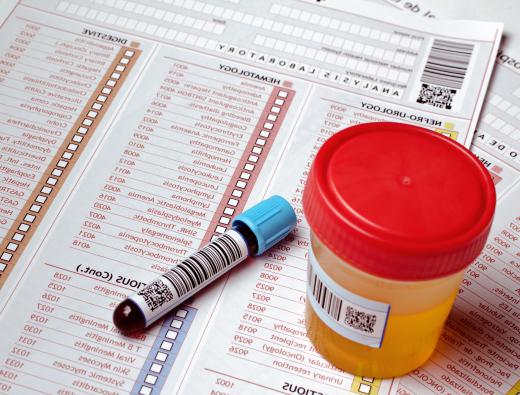 Blood and urine samples may be collected to detect hexachlorocyclohexane.