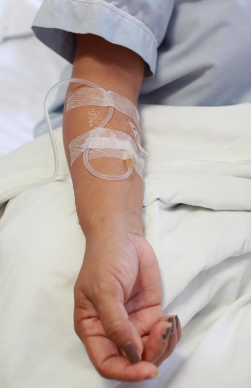 What Are The Most Common Intravenous Sites With Pictures